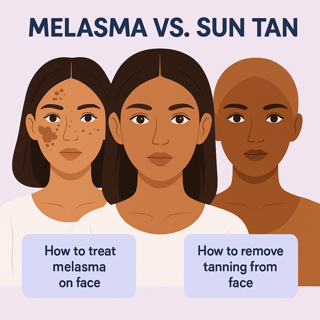 Difference between melasma and tan – Dr. Sachin Gupta, dermatologist in Faridabad